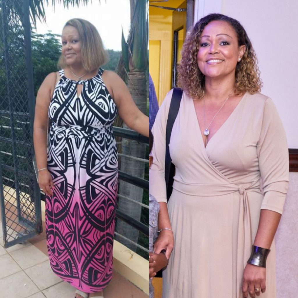 Weight loss transformation on keto
