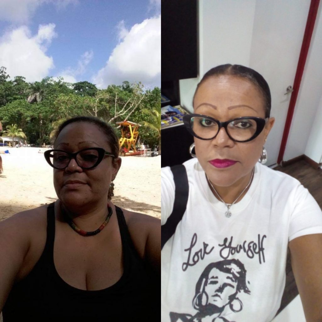 Weight loss transformation on keto Caribbean style 