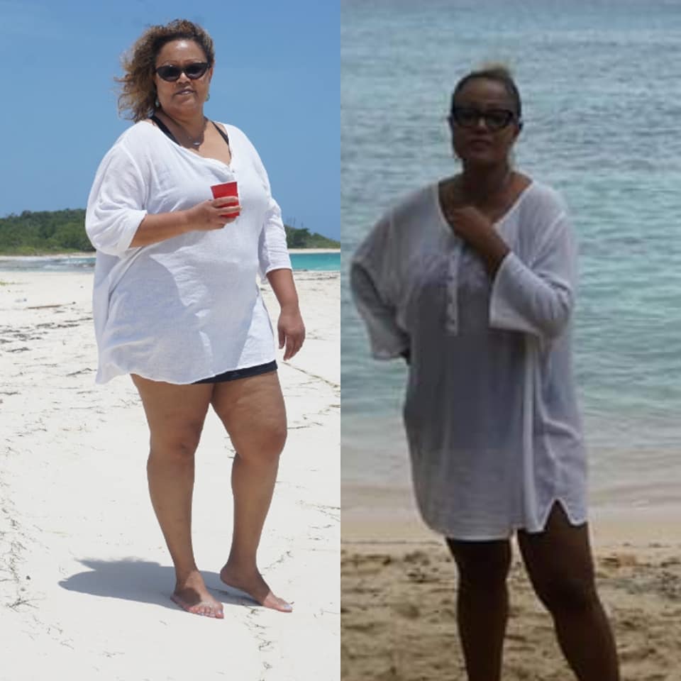 Before and During My Keto Journey