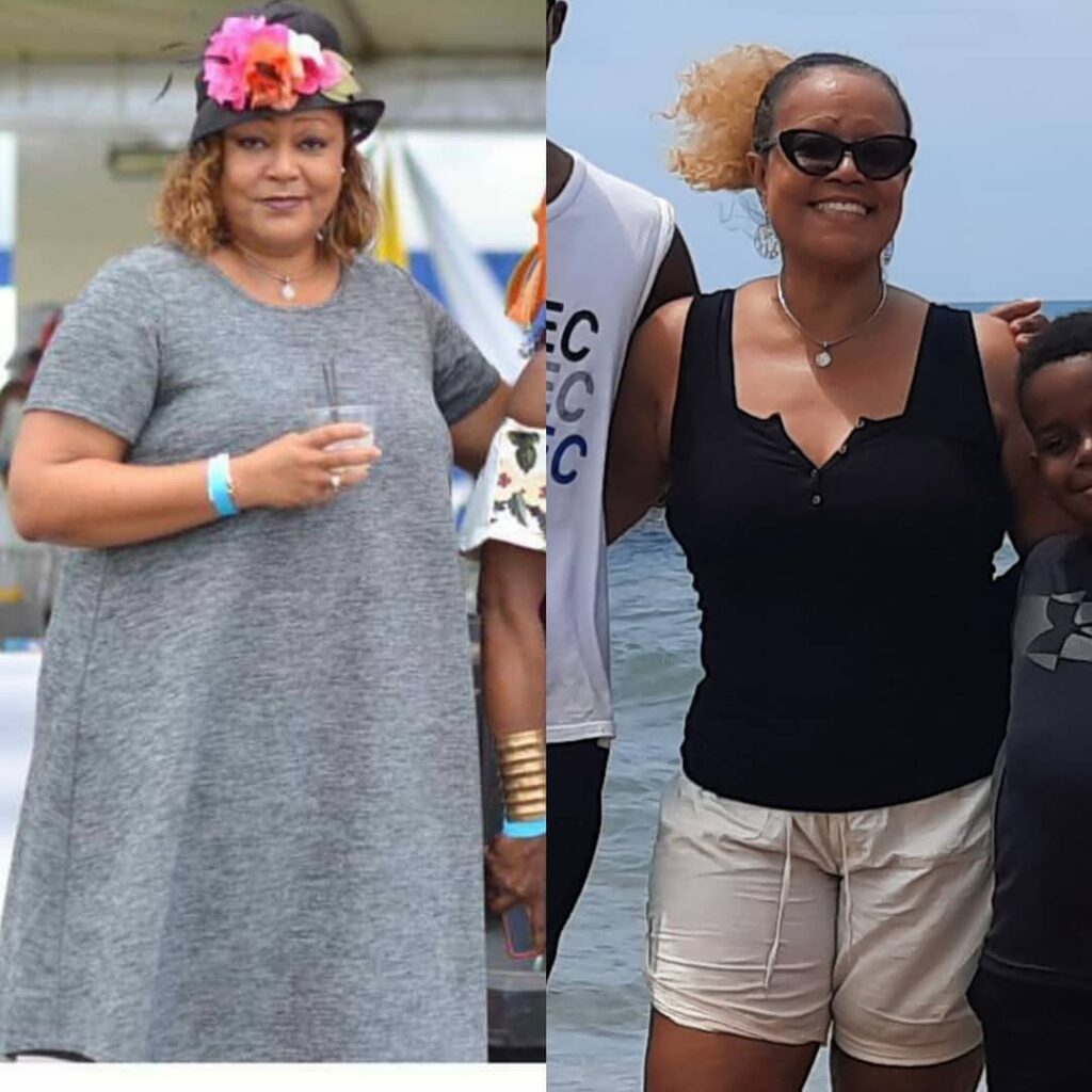 Before and after on the keto diet